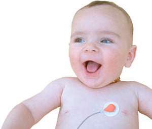 Monitor transcutáneo de CO2