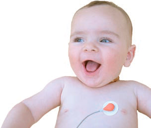 Monitor transcutáneo de CO2